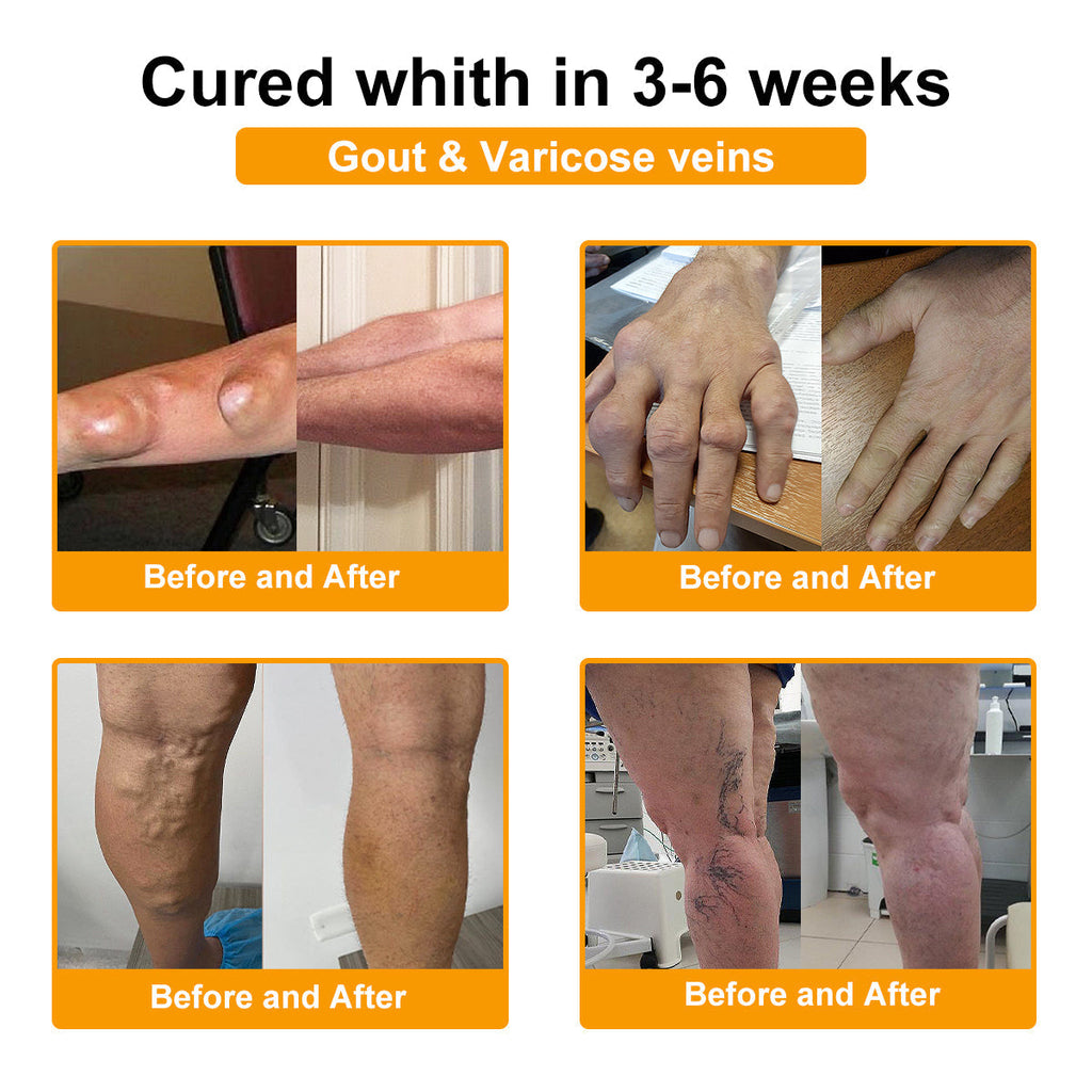 US DR.HONOR® All-In-One Joint & Bone Recovery Cream (Specially for older adults)