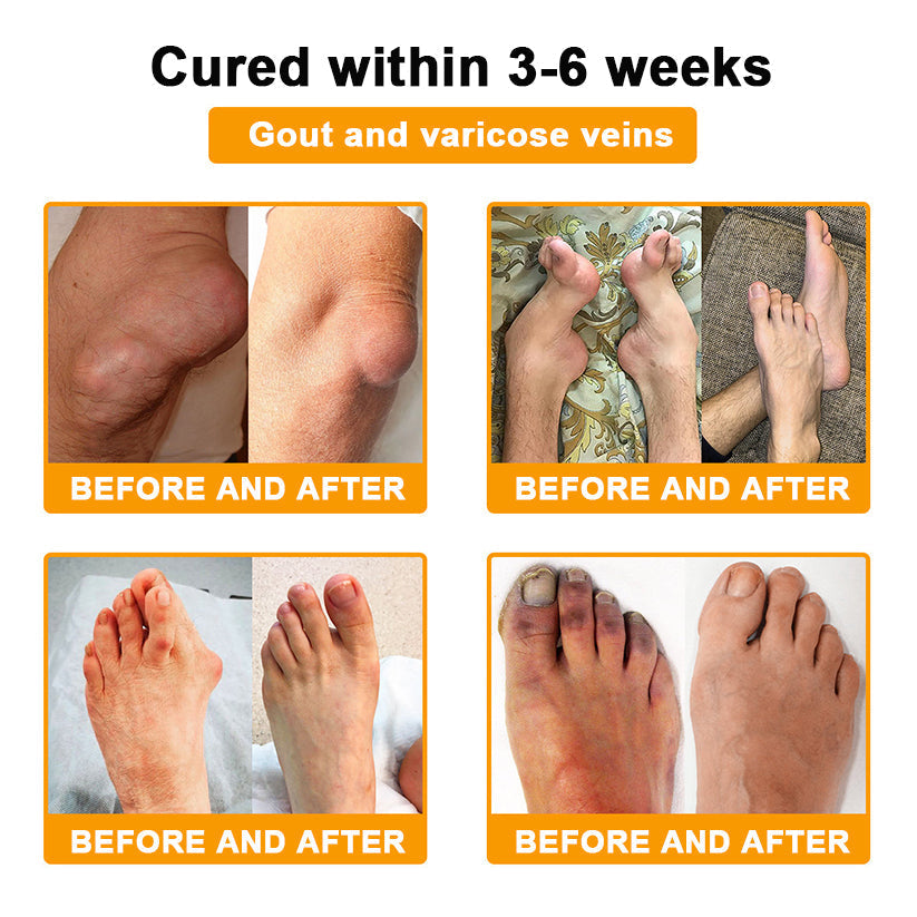US DR.HONOR® All-In-One Joint & Bone Recovery Cream (Specially for older adults)