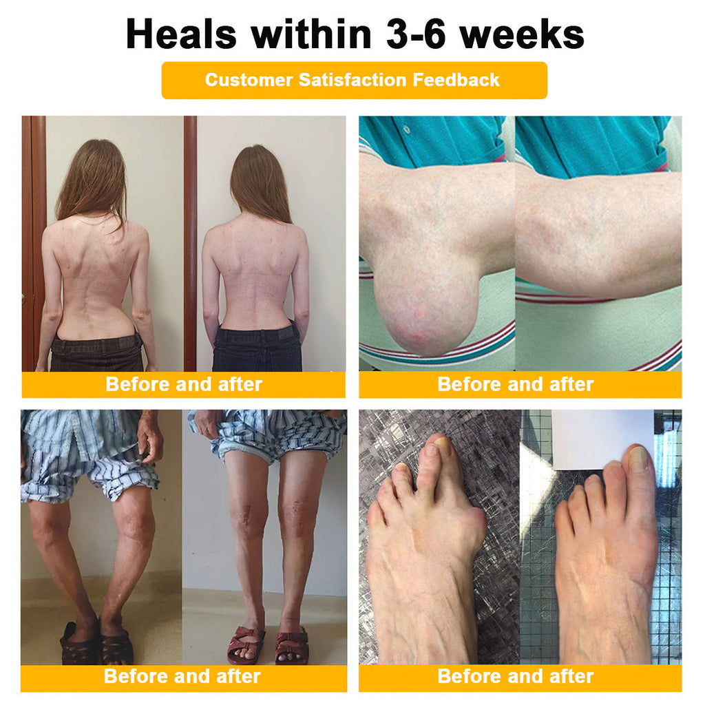 US DR.HONOR® All-In-One Joint & Bone Recovery Cream (Specially for older adults)