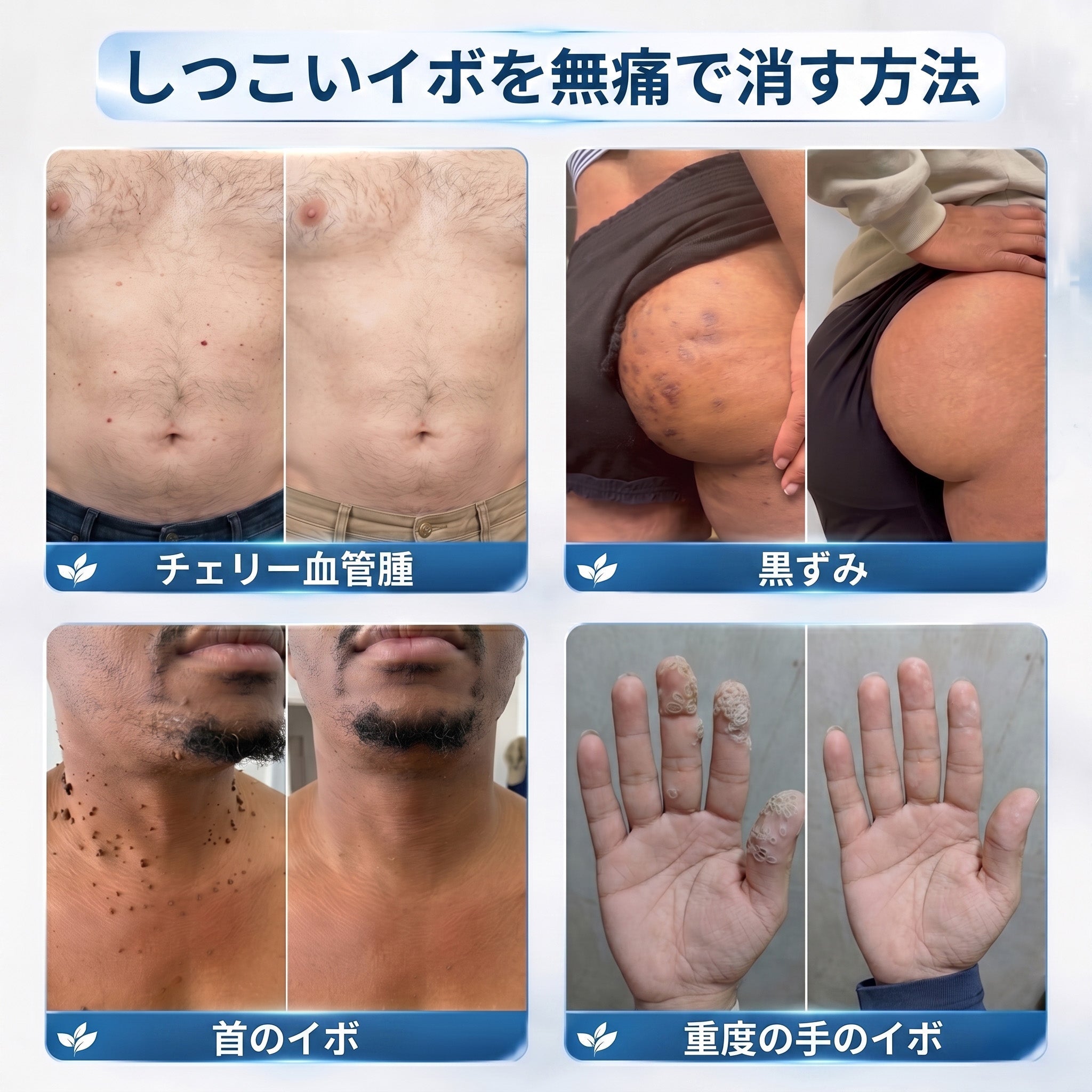 𝐇𝐈𝐒𝐊𝐈𝐍®👩‍⚕️ 7日間 スキンタグ＆スポットイレーサー｜痛み・傷跡を残さず、気になる肌悩みをケアする先進ローラーボールペン